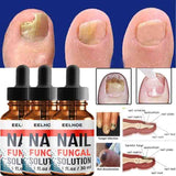 Nail Repair Serum Nail Fungal Treatment Serum Onychomycosis Paronychia Anti-Fungal Nail Infection  Toe Fungus Foot Repair  Care